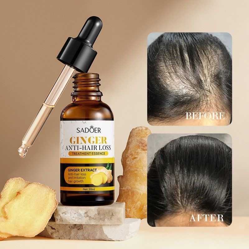 30ml SADOER Ginger Hair Care Serums Improve Dry and Frizzy Hair Oil