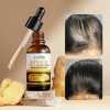 30ml SADOER Ginger Hair Care Serums Improve Dry and Frizzy Hair Oil